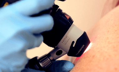 Métodos de diagnóstico para a verruga plantar