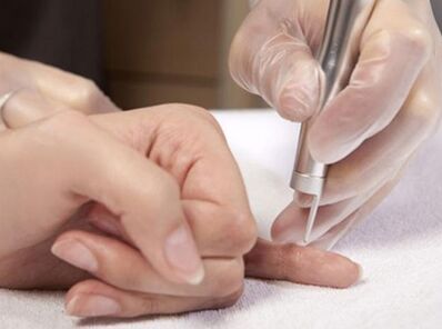 Realização de terapia a laser